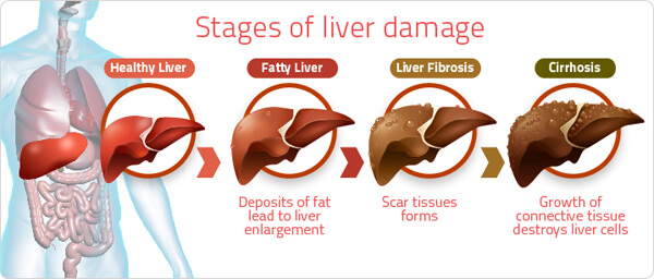 TUDCA Supplement for liver health